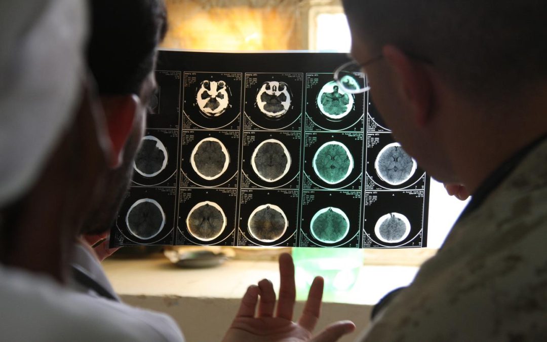 Iran war brain injuries could outlast US troops’ return to duty