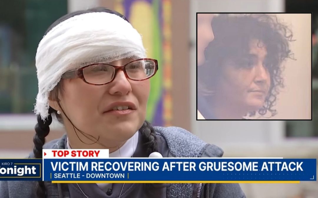 Woman walking to 7-Eleven on her work break was attacked on hotel steps by stranger who bit off piece of her face, police say