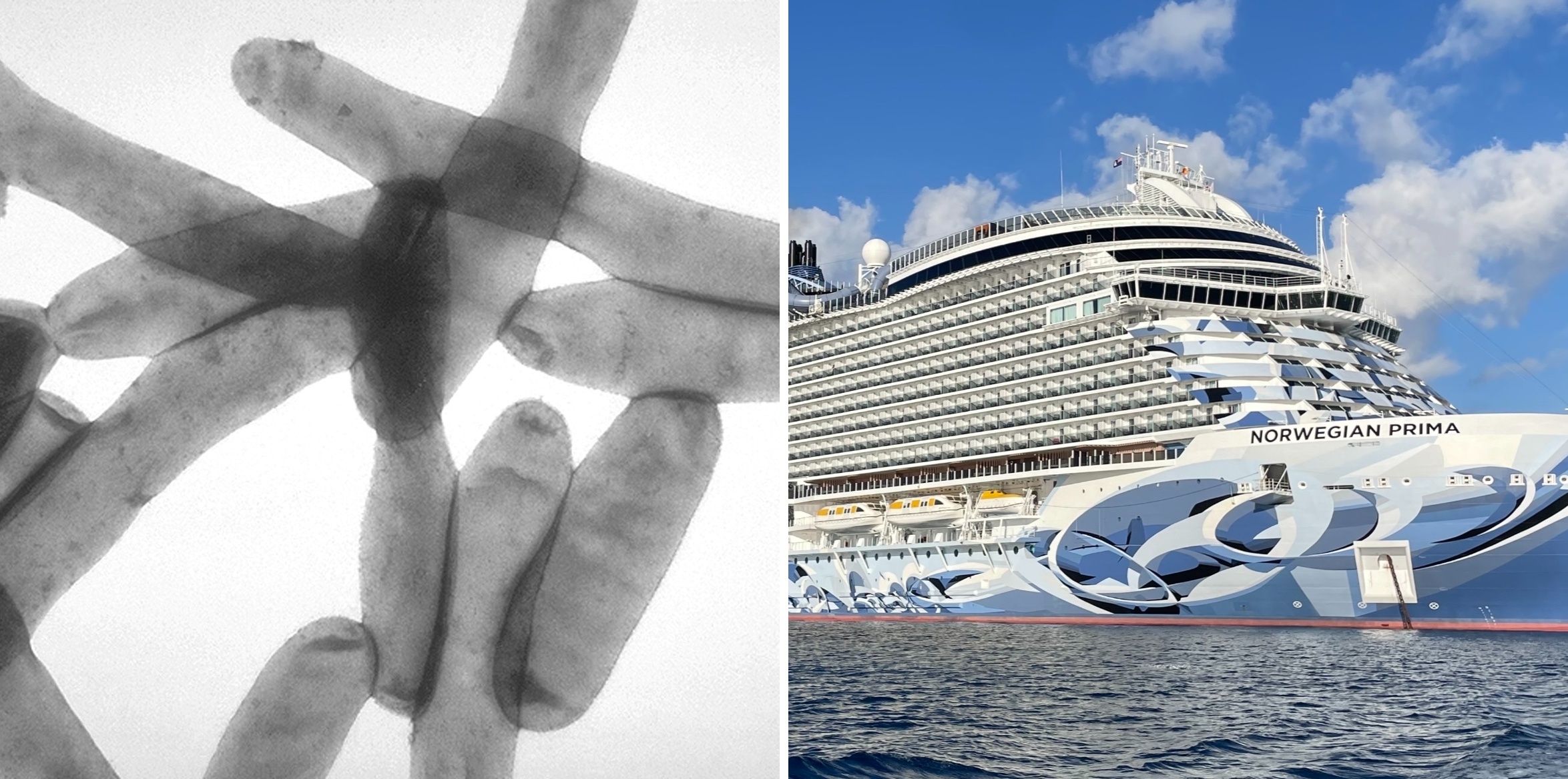 Three Passengers Sick with Legionnaires’ Disease After Cruising on Norwegian Prima