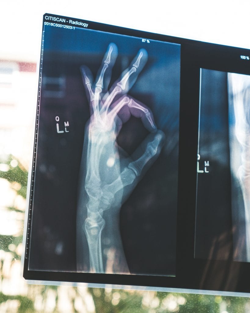 The Pressure to Look Fine After an Injury